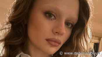 Joey King suffers facial burns after domestic accident