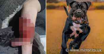 Horror dog attack as teen girl's arm ripped apart and she needs emergency surgery