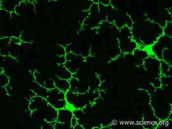 The acetyltransferase GCN5 contributes to neuroinflammation in mice by acetylating and activating the NF-κB subunit p65 in microglia | Science Signaling