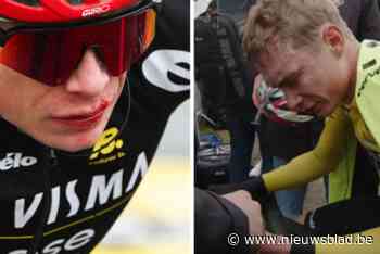IN BEELD. Gevallen Jonas Vingegaard leider af en “in tranen” na finishlijn in Parijs Nice door zorgen om pols