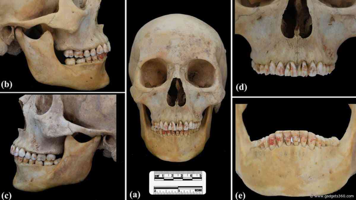 2,200-Year-Old Chinese Burial Uncovers Woman with Toxic Red-Stained Teeth