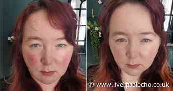I tried Amazon's Korean CC cream to cover my redness and it worked in seconds