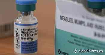 SHA issues measles exposure warning in Saskatoon and North Battleford