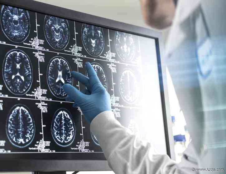 What to do and not do if someone is having a stroke