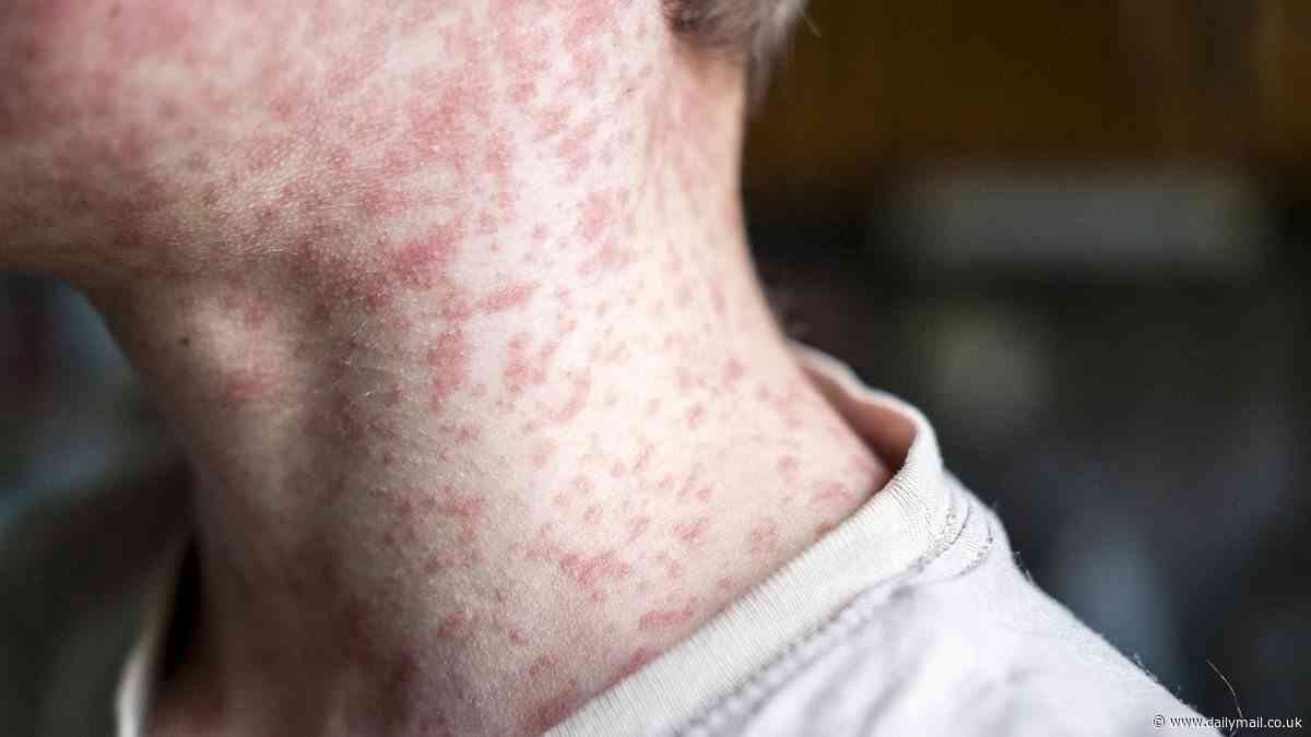 Major outbreak fears as world's most contagious disease hits baseball game attended by 40,000