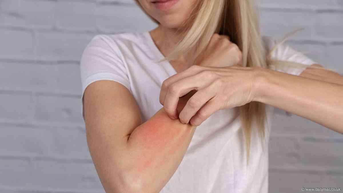 One in four women say menopause triggered eczema symptoms
