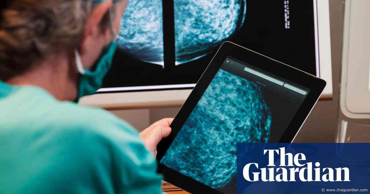 NHS England aims for faster cancer treatment with new data tool
