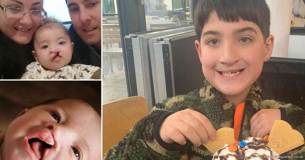 “My cleft is my difference – it’s a bit cool because it makes me unique”