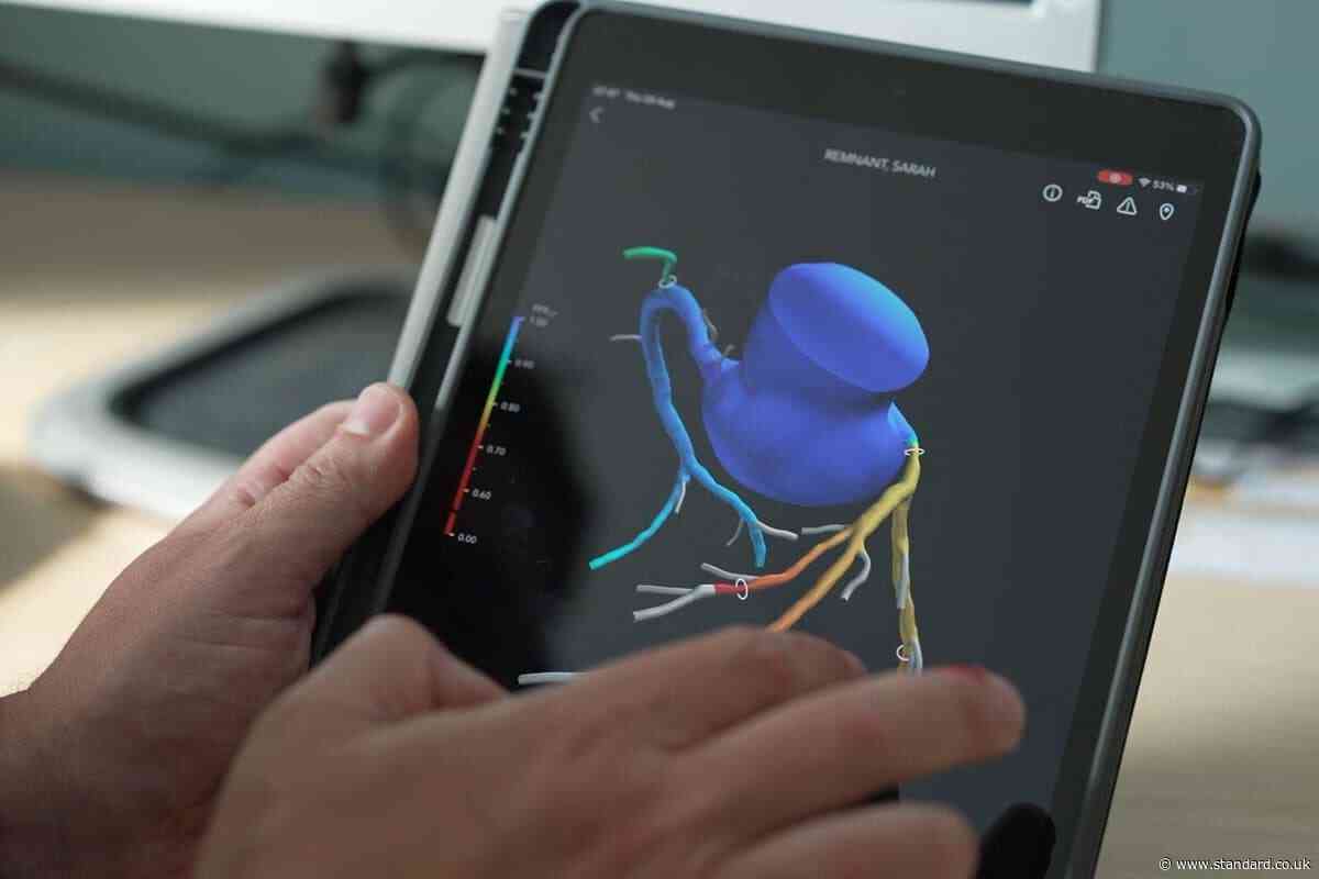 3D heart scans have saved NHS millions since 2021 rollout, data shows