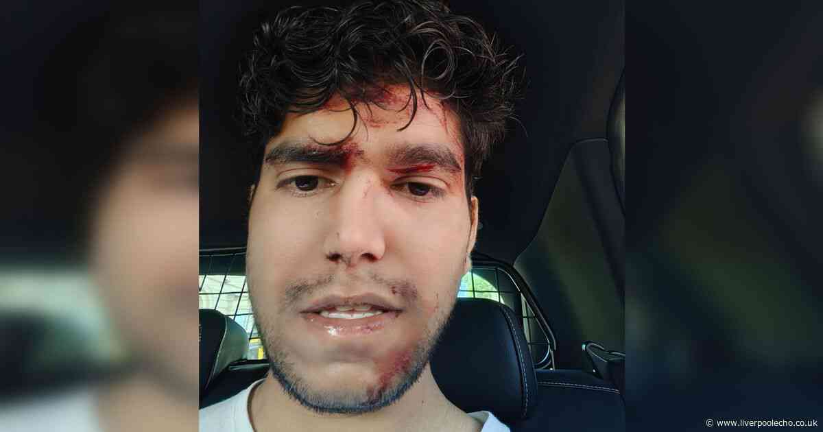 Man 'starting to think he made a big mistake' after nasty attack on his way to work