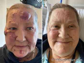 Once given days to live, this B.C. cancer patient is back home after a clinical trial