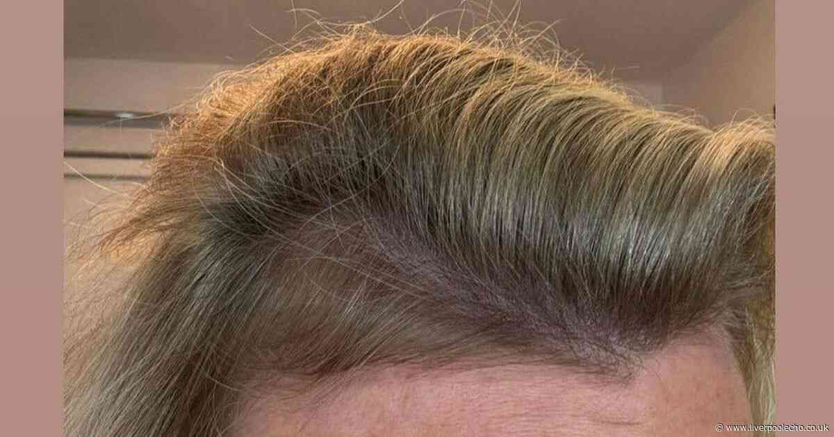 Amazon shoppers praise £9.99 hair growth supplement with 'miracle' results