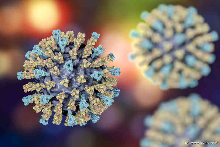 New measles exposure in Austin: Officials warn residents after El Paso resident's visit