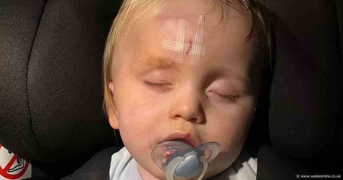 Mum's warning to parents after pair of sunglasses put toddler in hospital