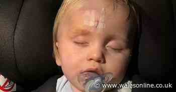 Mum's warning to parents after pair of sunglasses put toddler in hospital