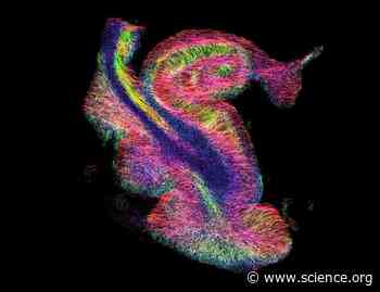 Insights into the intramembrane protease SPPL2b and its substrates: Functions and disease implications | Science Signaling