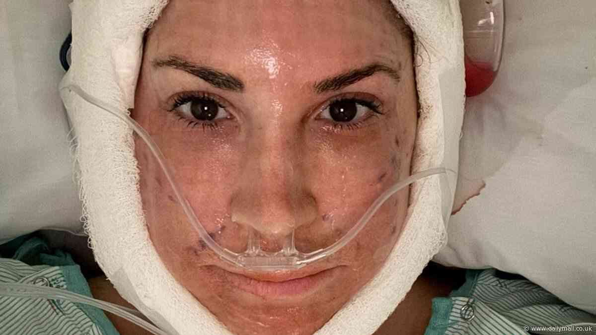 Real Housewives star, 55, reveals she had a full facelift while sharing frightening post-op photos