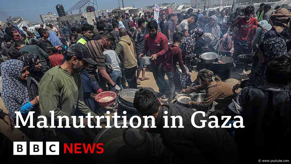 Malnutrition rises in Gaza as Israeli blockade enters third month | BBC News