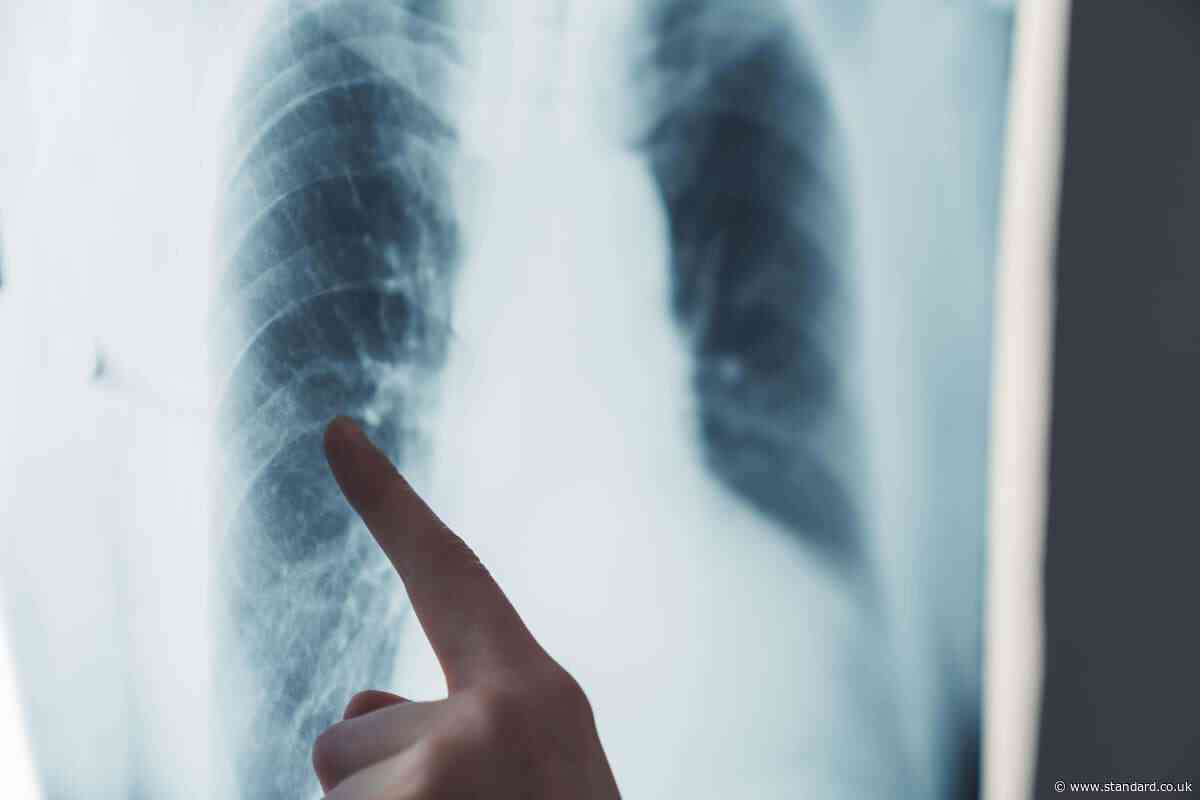 AI model being trained with NHS data from 57m people ‘could predict disease’