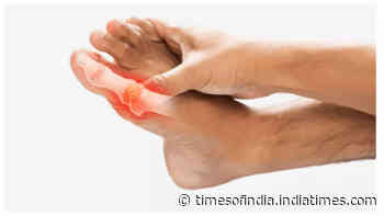 5 symptoms of high uric acid that often go unnoticed