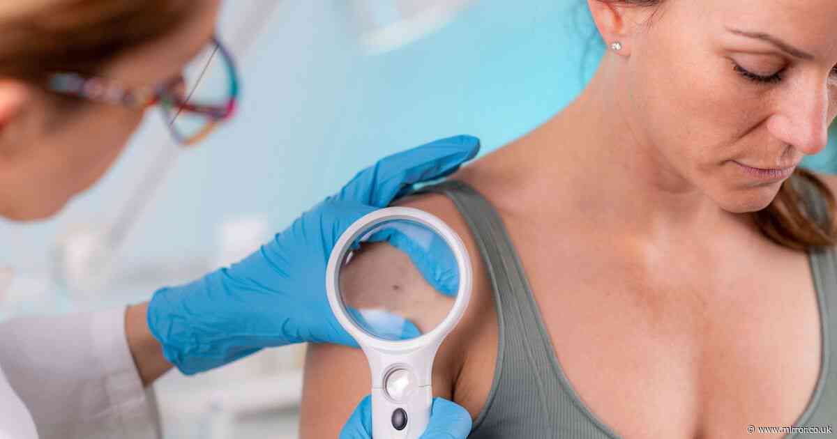 '15-minute skin cancer check at Boots could've saved my life - and only cost £40'