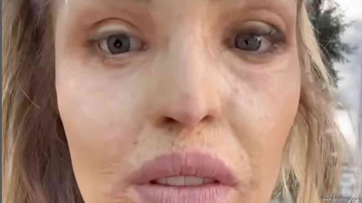 Katie Piper shows off her new glass eye in remarkable before and after shots after travelling to Hamburg for pioneering treatment