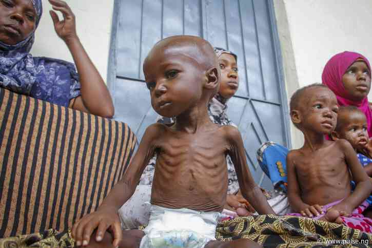 Nigeria has the most malnourished children in Africa — 2nd globally