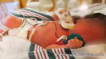 Haunting photo of hours-old newborn dumped in trash can with umbilical cord still attached