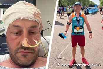 Runner George's migraines turned out to be two brain tumours