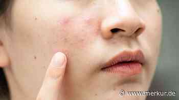 Retinol ist nicht für jede Haut geeignet – das rät eine Dermatologin