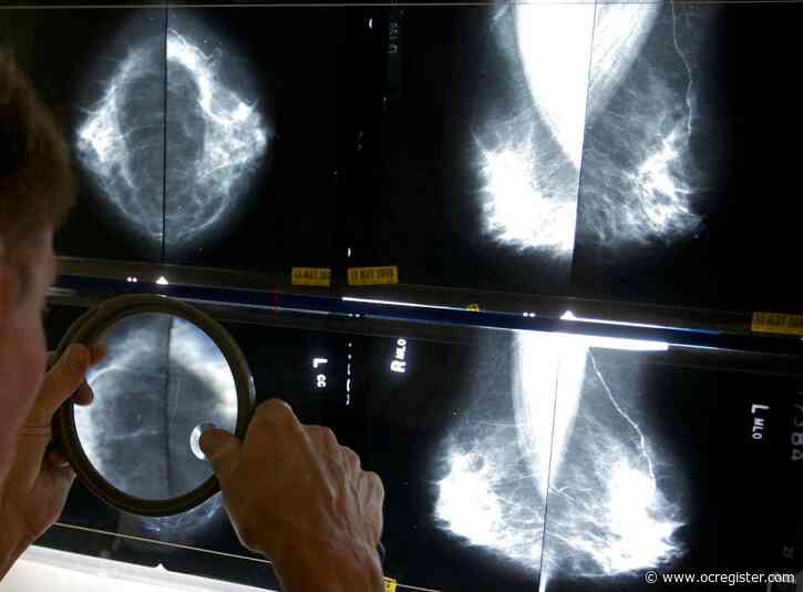 Cancer before age 50 is increasing. A new study looks at which types