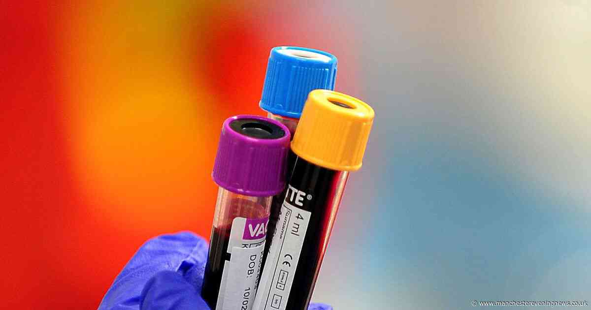Annual blood test for 12 cancers could be a 'game-changer' in detecting disease