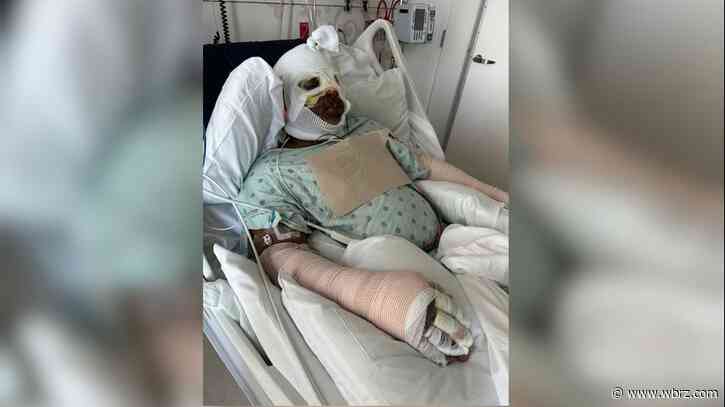 'I'm glad nobody else got hurt:' Man hospitalized, burned after boat explosion at Tickfaw 200