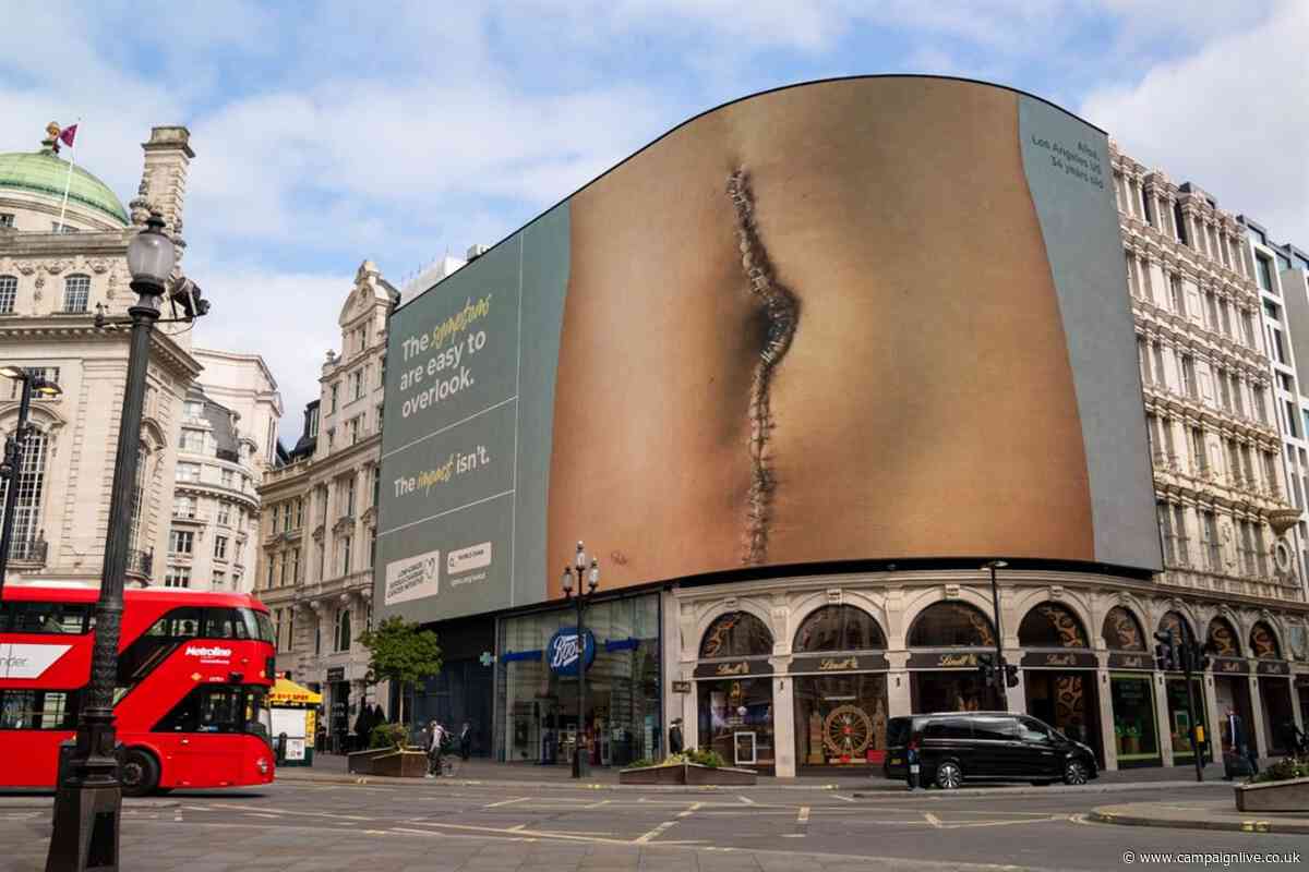 World Ovarian Cancer Day campaign features scars of real women