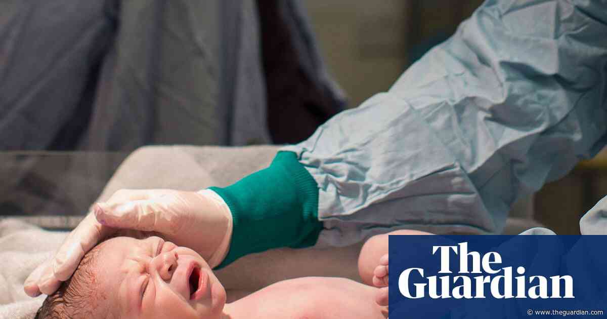 NHS scheme to prevent brain injuries in childbirth extended across England