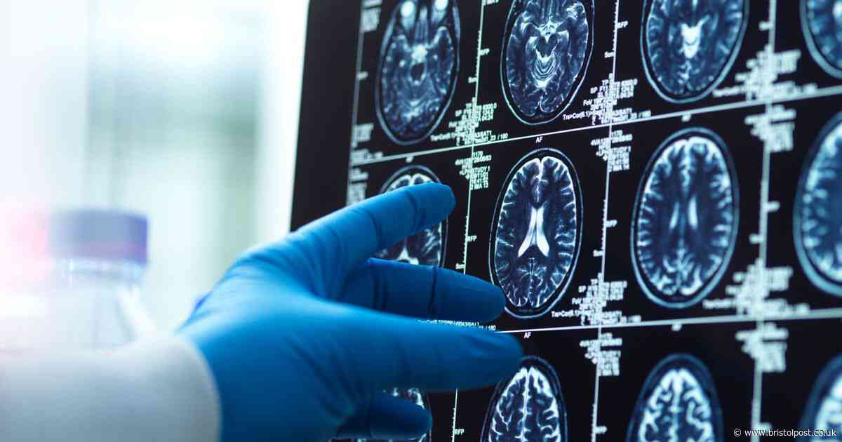 Working too hard physically changes shape of your brain, study shows
