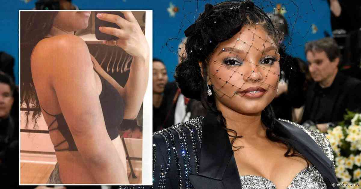Halle Bailey granted restraining order after showing bruises from ex’s ‘ongoing abuse’