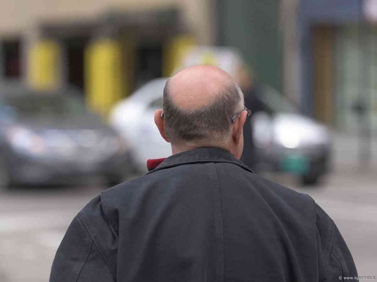 L'allarme sul farmaco contro la caduta dei capelli: cosa provoca