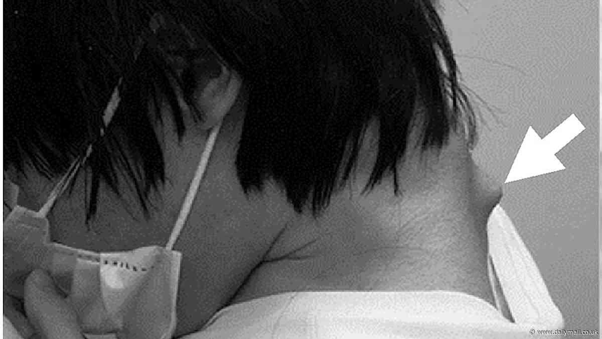 Gamer, 25, develops terrifying 'dropped head syndrome' from looking at his phone too much - doctors issue warning
