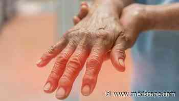 Guillain-Barré Syndrome: When to Suspect, What to Rule Out