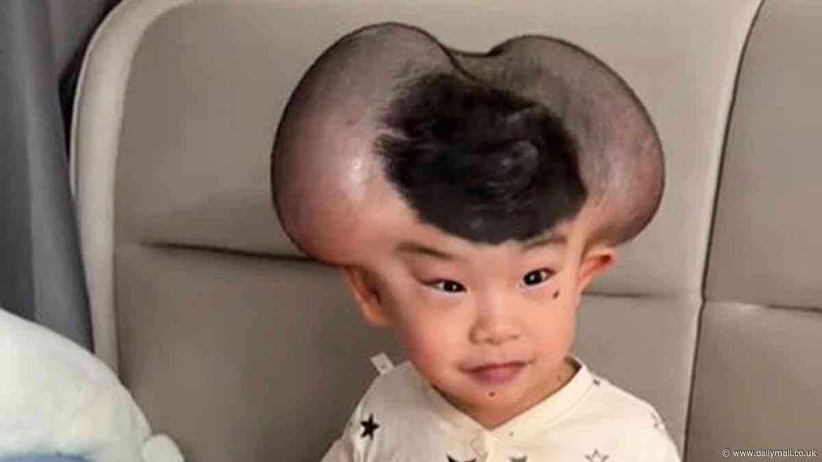 Parents of boy cruelly nicknamed 'Mickey Mouse' over giant growths caused by treatment for rare skin condition share their joy as he makes amazing transformation