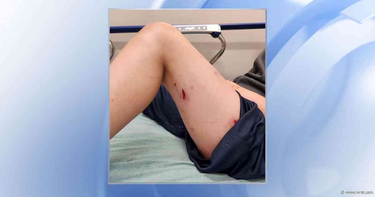 Dog attack at Wake County Animal Center leaves mother and daughter injured