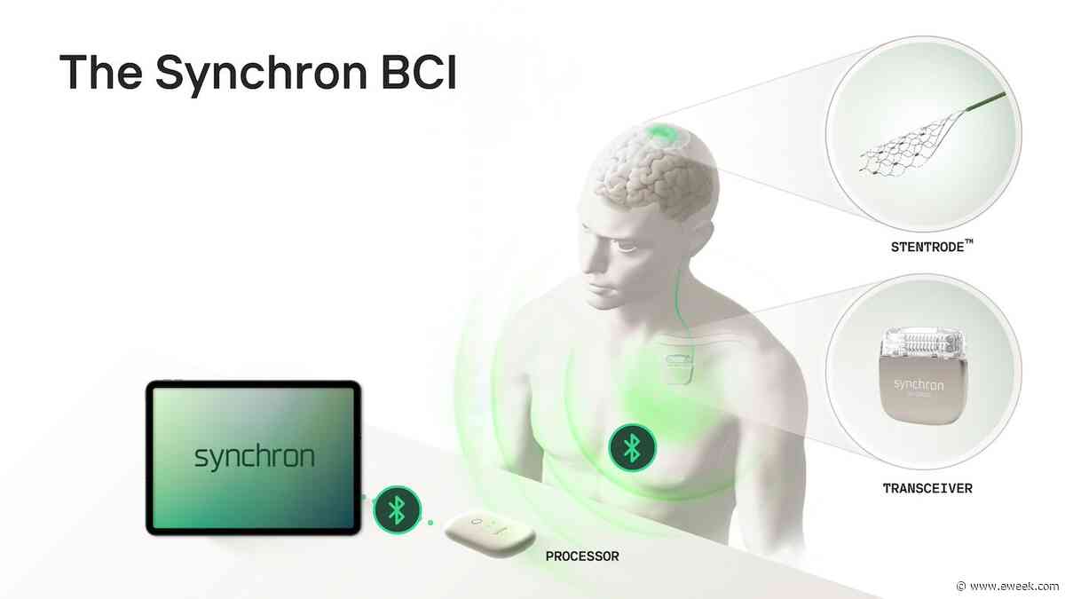 Brain-Controlled iPhones: Apple’s Helping Pioneer This Next-Gen Accessibility Tech