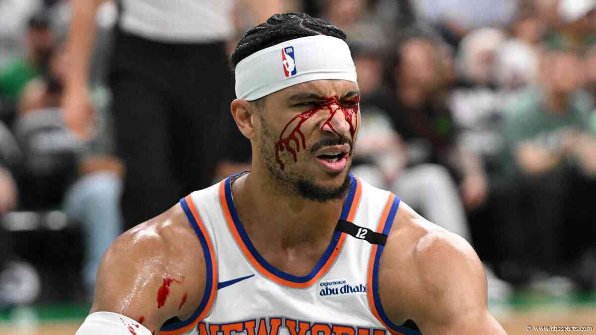 WATCH: Knicks' Josh Hart bloodied by elbow to face from Celtics' Luke Kornet in Game 5