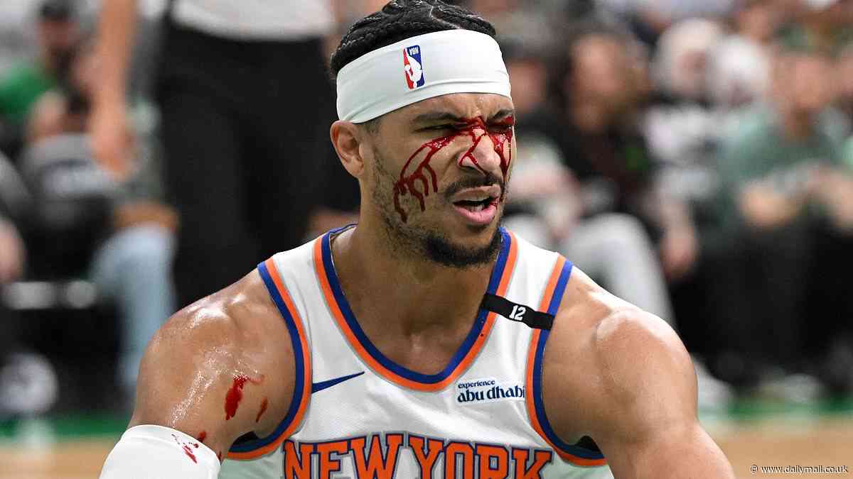 Knicks star Josh Hart gushes blood onto court in gruesome NBA playoff injury: 'Might need a transfusion'