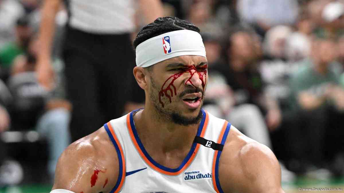 Knicks star bloodied in freak incident as Celtics keep Playoffs dream alive