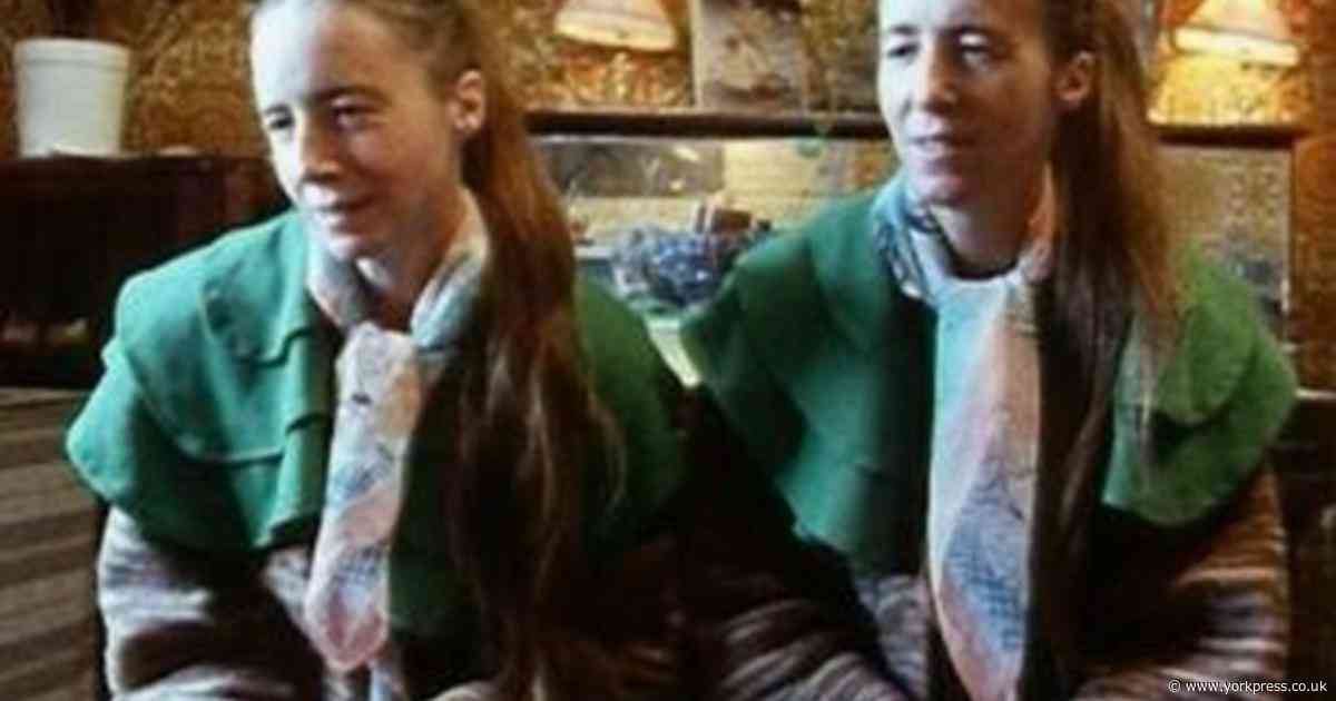 The real-life facts about York's strangest twins, Greta and Freda Chaplin