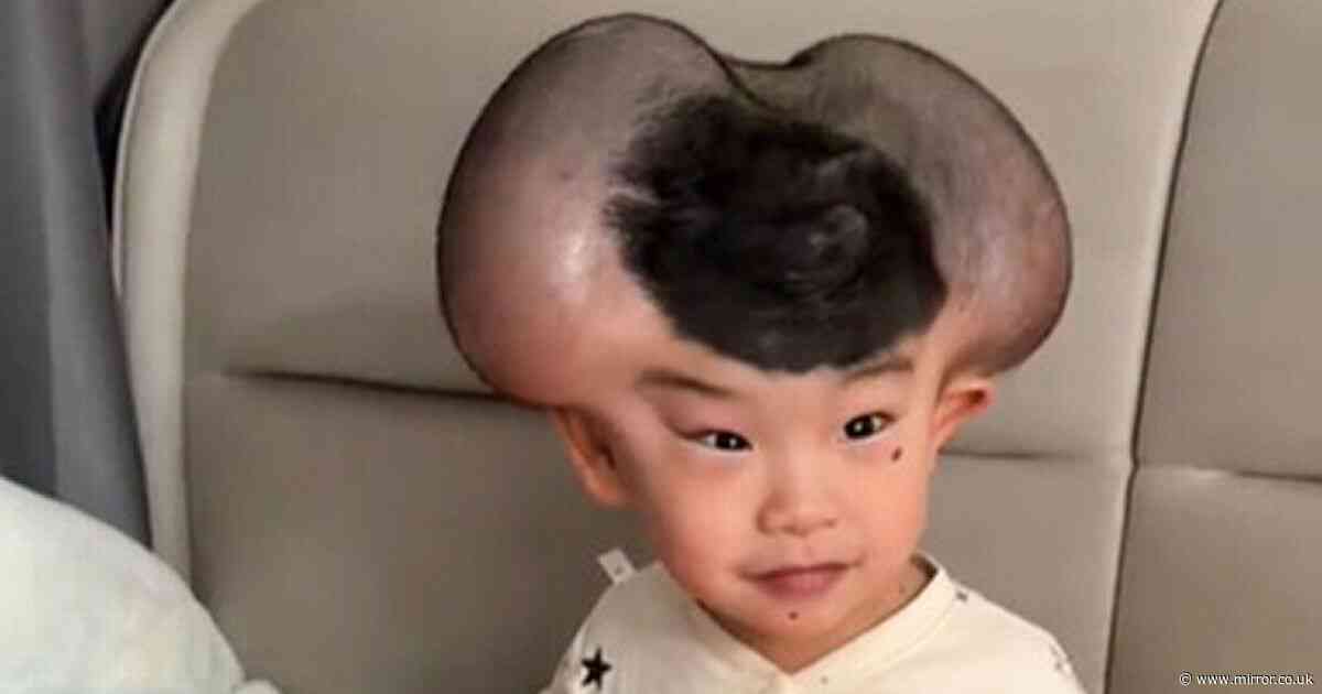 Boy makes wild transformation after rare condition earned him 'Mickey Mouse' nickname