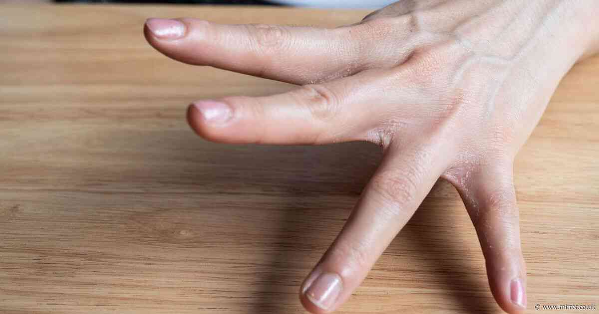 Lung cancer doctors say early sign of disease can appear on your fingertips