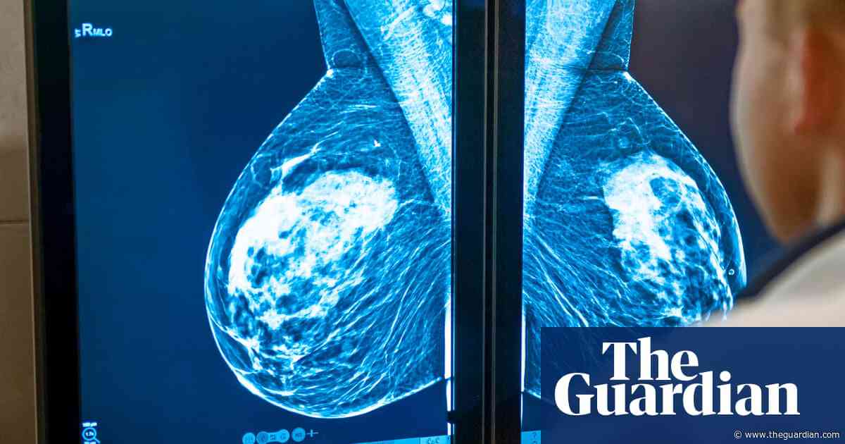 NHS gave private firms record £216m to examine X-rays in 2024